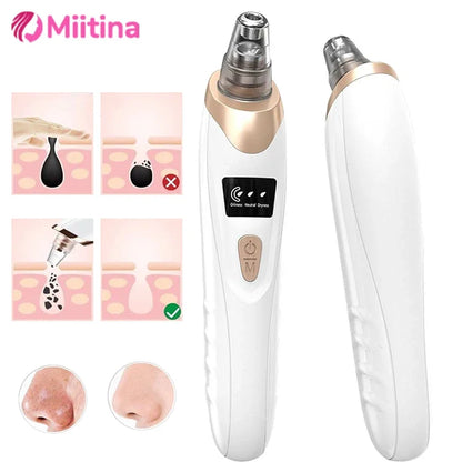 ✨ Electric Blackhead Remover Vacuum – USB Rechargeable Facial Pore Cleaner Deep, Painless, and Effective Skincare at Home