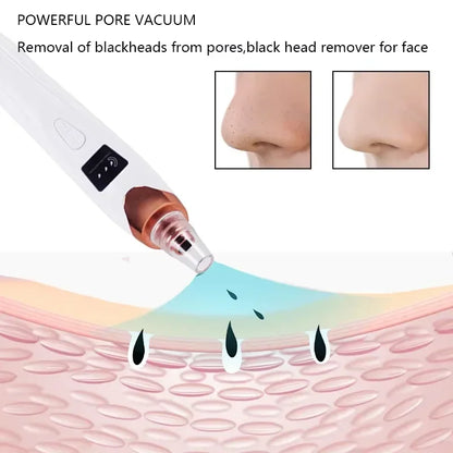 ✨ Electric Blackhead Remover Vacuum – USB Rechargeable Facial Pore Cleaner Deep, Painless, and Effective Skincare at Home