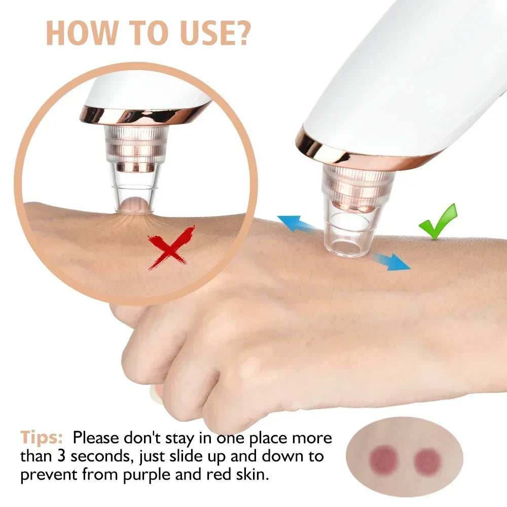 ✨ Electric Blackhead Remover Vacuum – USB Rechargeable Facial Pore Cleaner Deep, Painless, and Effective Skincare at Home